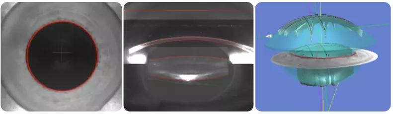 Computer-processed images for laser cataract surgery that allows to identify the pupil, cornea, front & back lens surface
