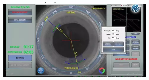 Re-shaping of the cornea without the need for blades