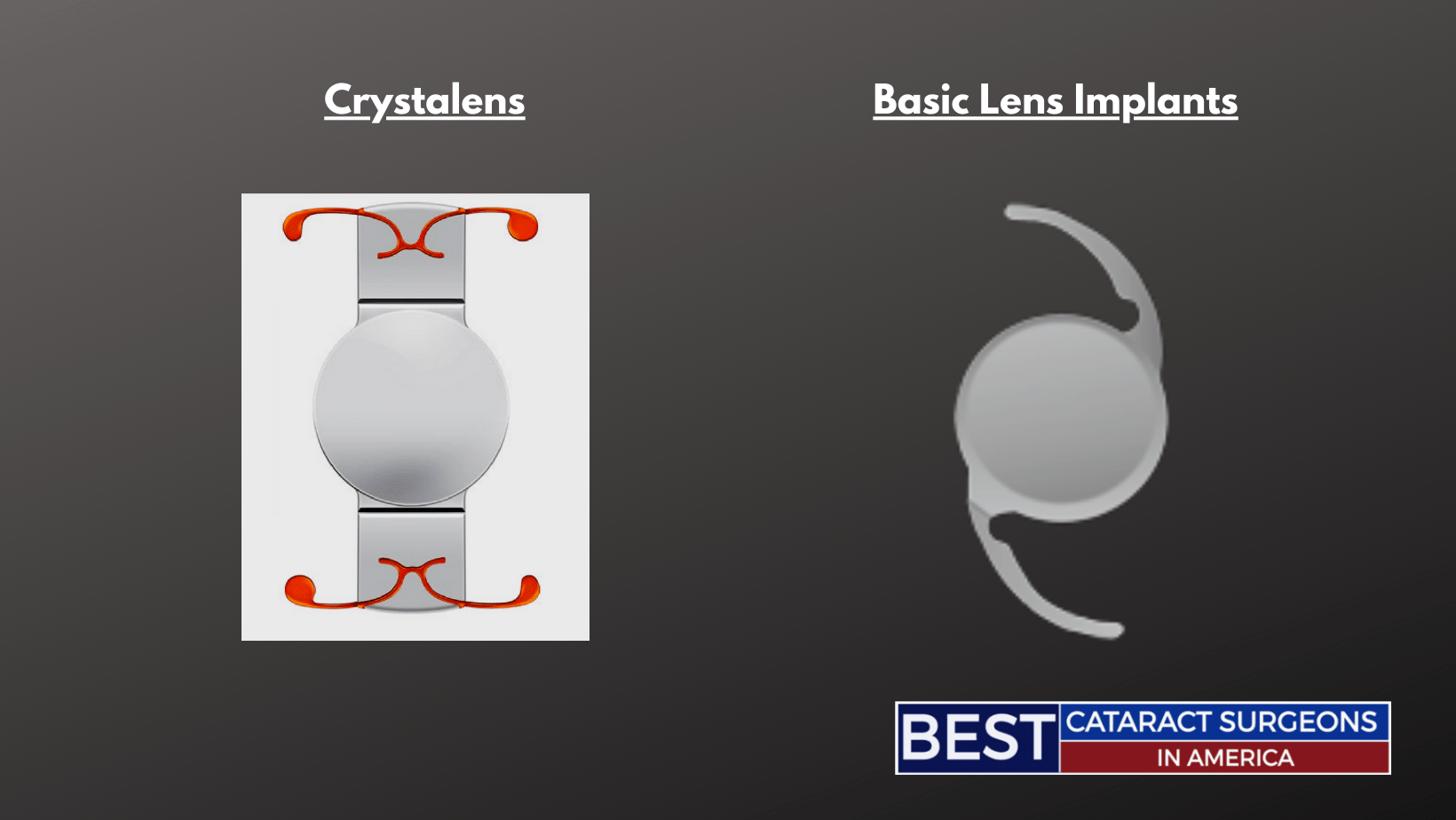 Crystalens versus Basic Lens for Cataract Surgery