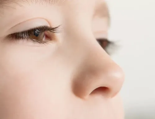 Cataracts in Children