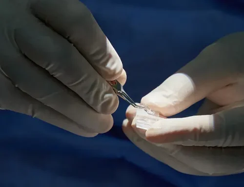 PanOptix Pro Lens Implant Review: Pros, Cons, Cost & How It Compares to PanOptix