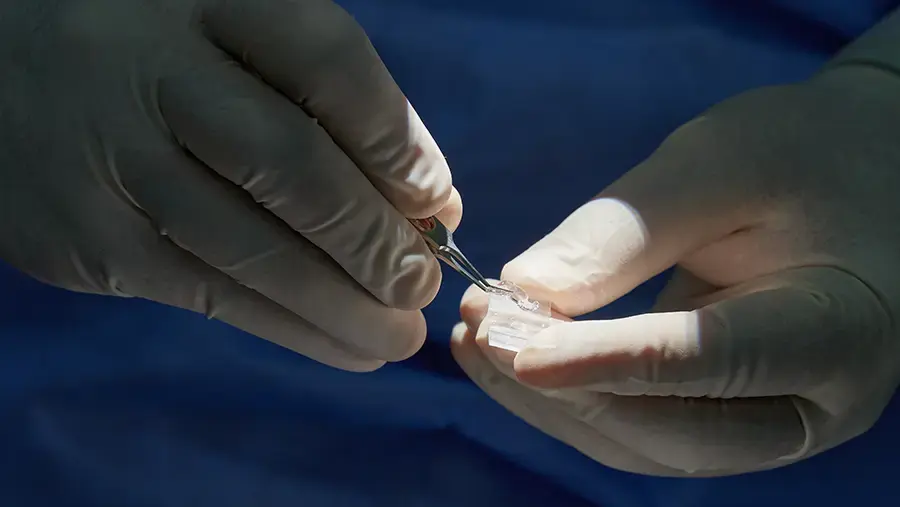 PanOptix Pro Lens Implant Review: Pros, Cons, Cost & How It Compares to PanOptix