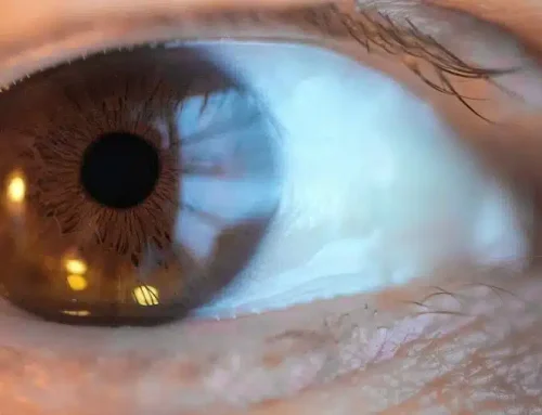 enVista Envy Lens Implant Review: Bausch + Lomb’s Next-Generation Multifocal Cataract Lens