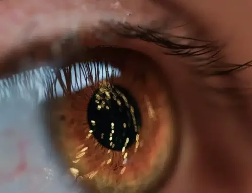 PanOptix Pro vs Envy: Comparing Two Advanced Multifocal Lens Implants