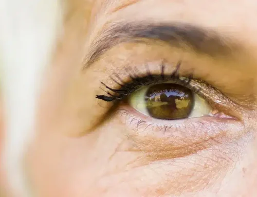 Blue Light Filtering Intraocular Lenses: Do They Protect Your Eyes?